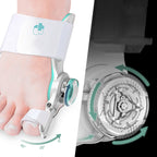 Foot orthosis device with a close-up of its internal mechanism on a white background